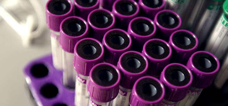 blood tubes